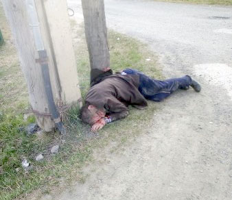 В Белорецке на городской улице лежал без сознания окровавленный мужчина