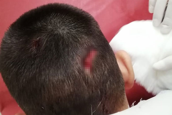 В Салавате мальчик получил травму головы от упавшей сосульки