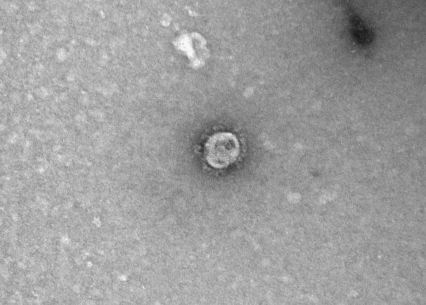 Как выглядит коронавирус под микроскопом: российские ученые сделали фото