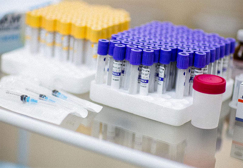 В Башкирии будут производить до 3 тысяч тестов на коронавирус