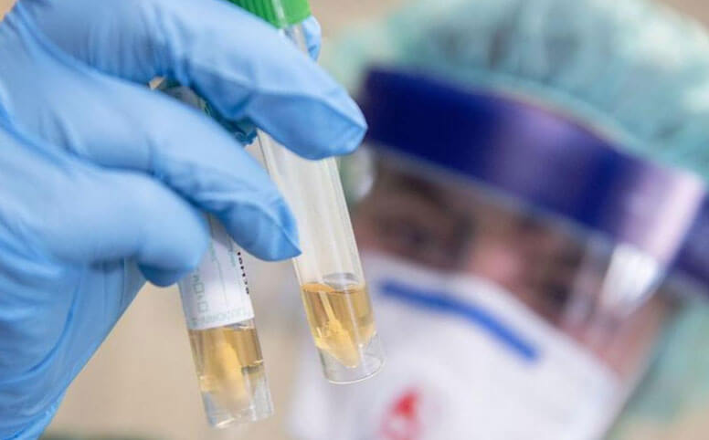 В Башкирии тест на коронавирус планируют сделать платным