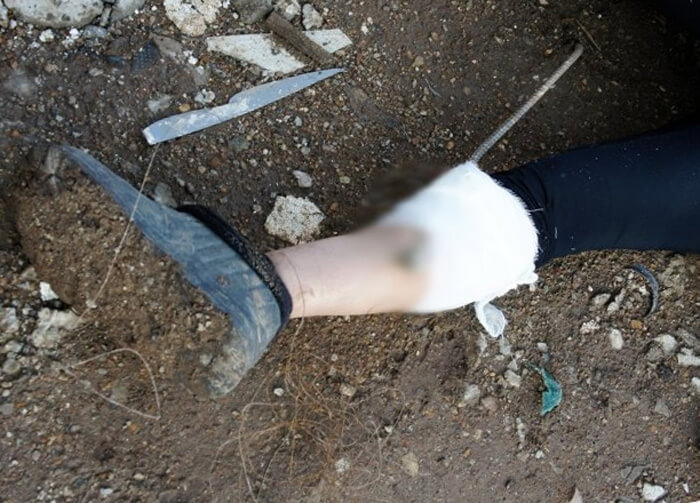 В Уфе женщина проткнула арматурой ногу | видео