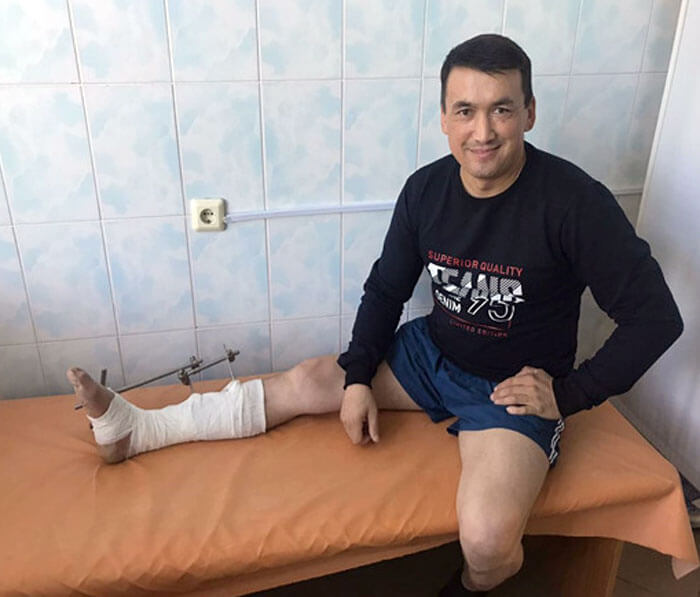 Уфимские врачи пришили жителю Баймакского района отрезанную косилкой ногу