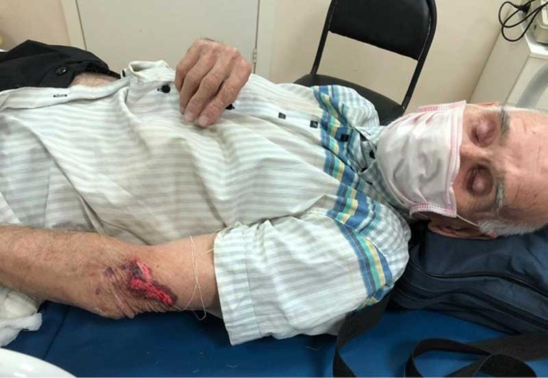 В центре Уфы электросамокатчик сбил 84-летнего мужчину