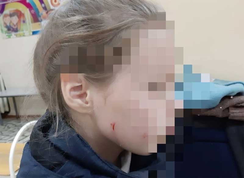 В Башкирии пенсионерка избила школьницу за то, что та кормила бездомных кошек