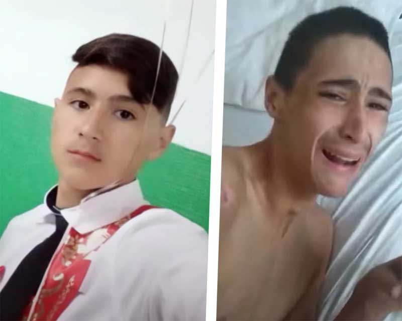 В Башкирии 17-летний парень стал инвалидом после удаления аппендикса