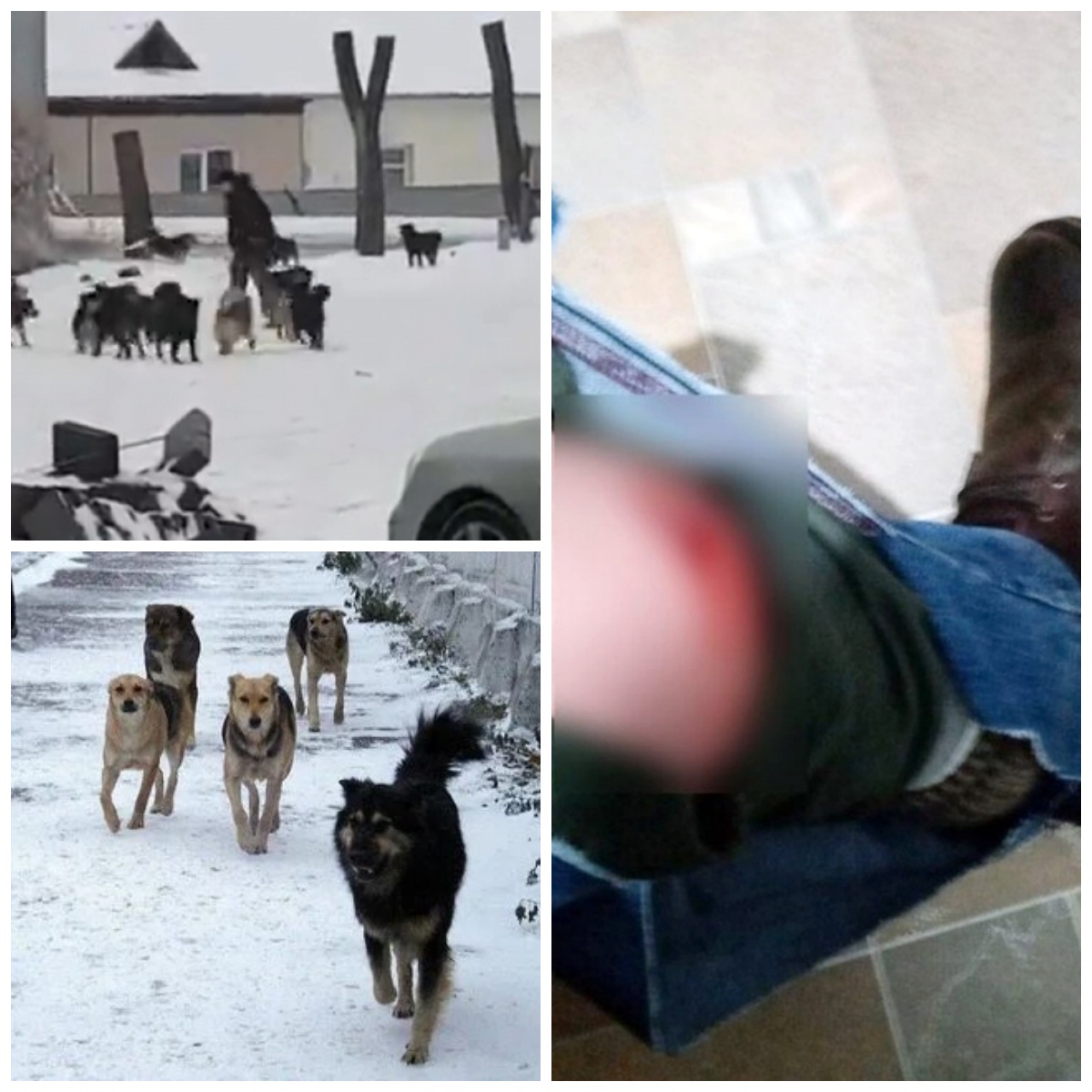 В России стая собак едва не разорвала взрослого мужчину