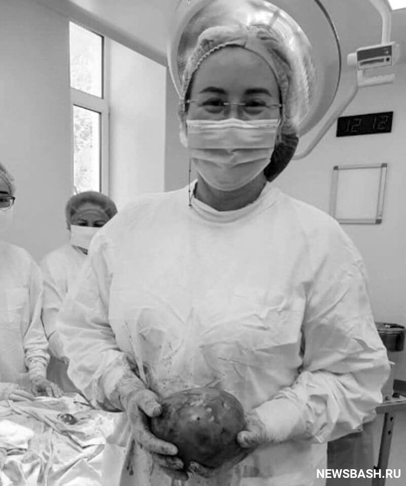 В Башкирии врачи вырезали беременной женщине огромную опухоль
