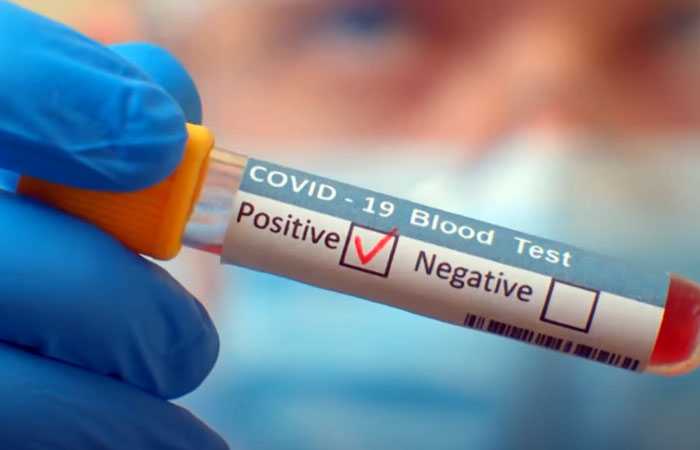 В Башкирии еще у 67 человек за истекшие сутки выявили коронавирус
