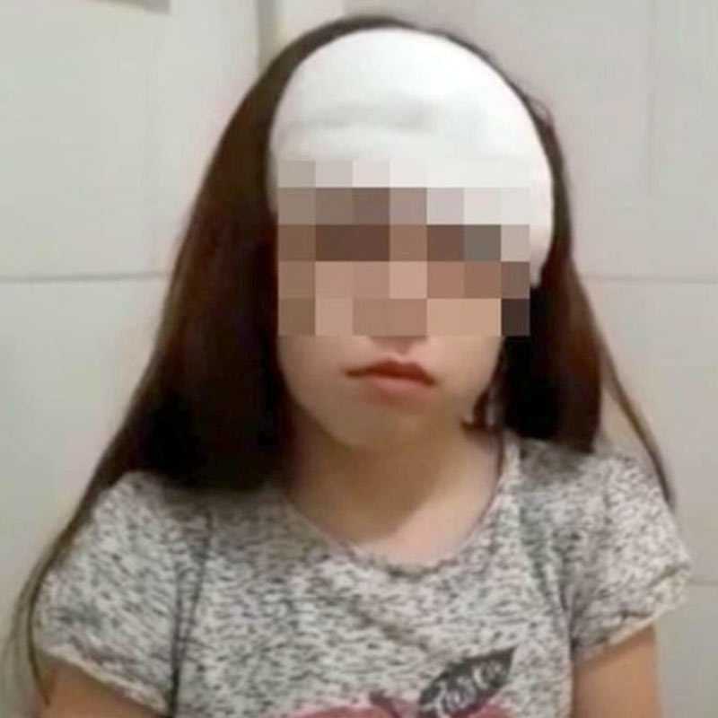В Башкирии хозяйка собаки, которая покусала девочку, отделалась штрафом в 5 тысяч рублей
