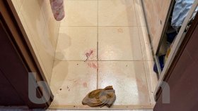 В Минздраве сообщили о самочувствии раненного в Уфе ножом подростка