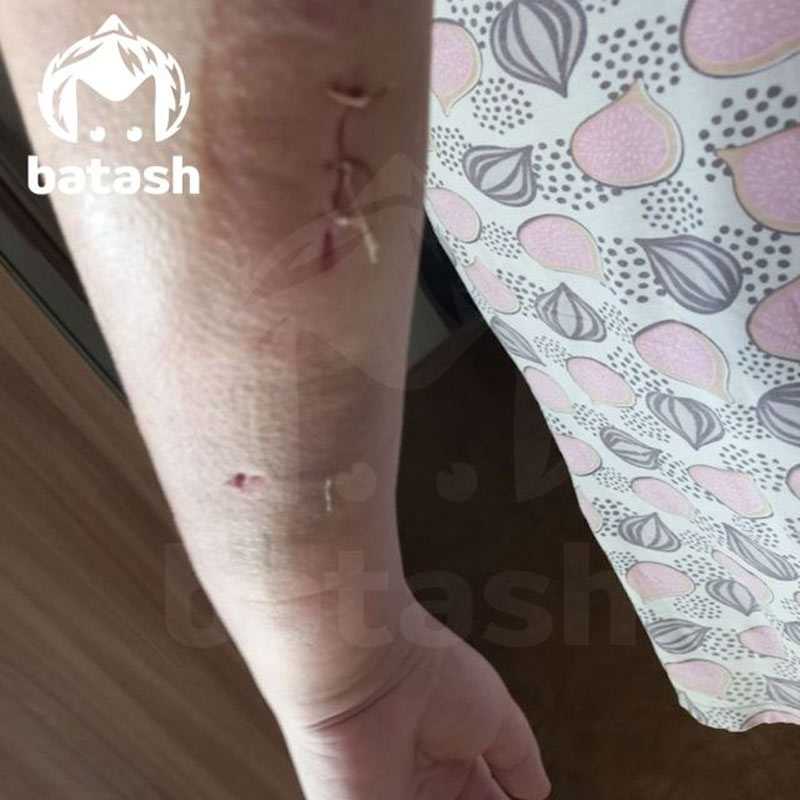 В Башкирии подростки подстрелили женщину с ребёнком на руках, извинились и убежали