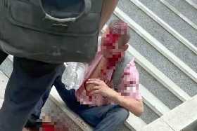 В Уфе возле института МВД мужчине пробили кирпичом голову