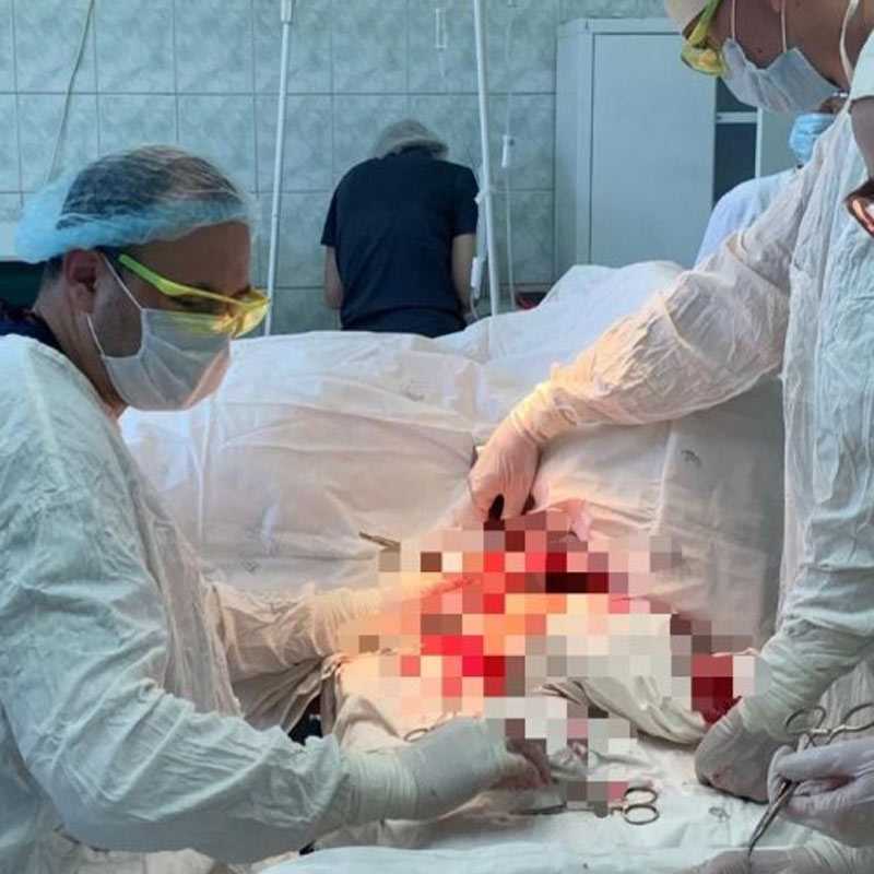 В Башкирии врачи спасли изувеченного бензопилой мужчину
