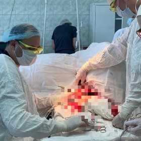 В Башкирии врачи спасли изувеченного бензопилой мужчину