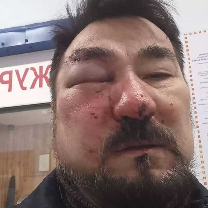 В Башкирии неизвестные избили солиста группы «Караван Сарай»