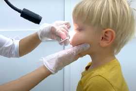 Промедление может стоить жизни: врач раскрыла опасность носовых кровотечений