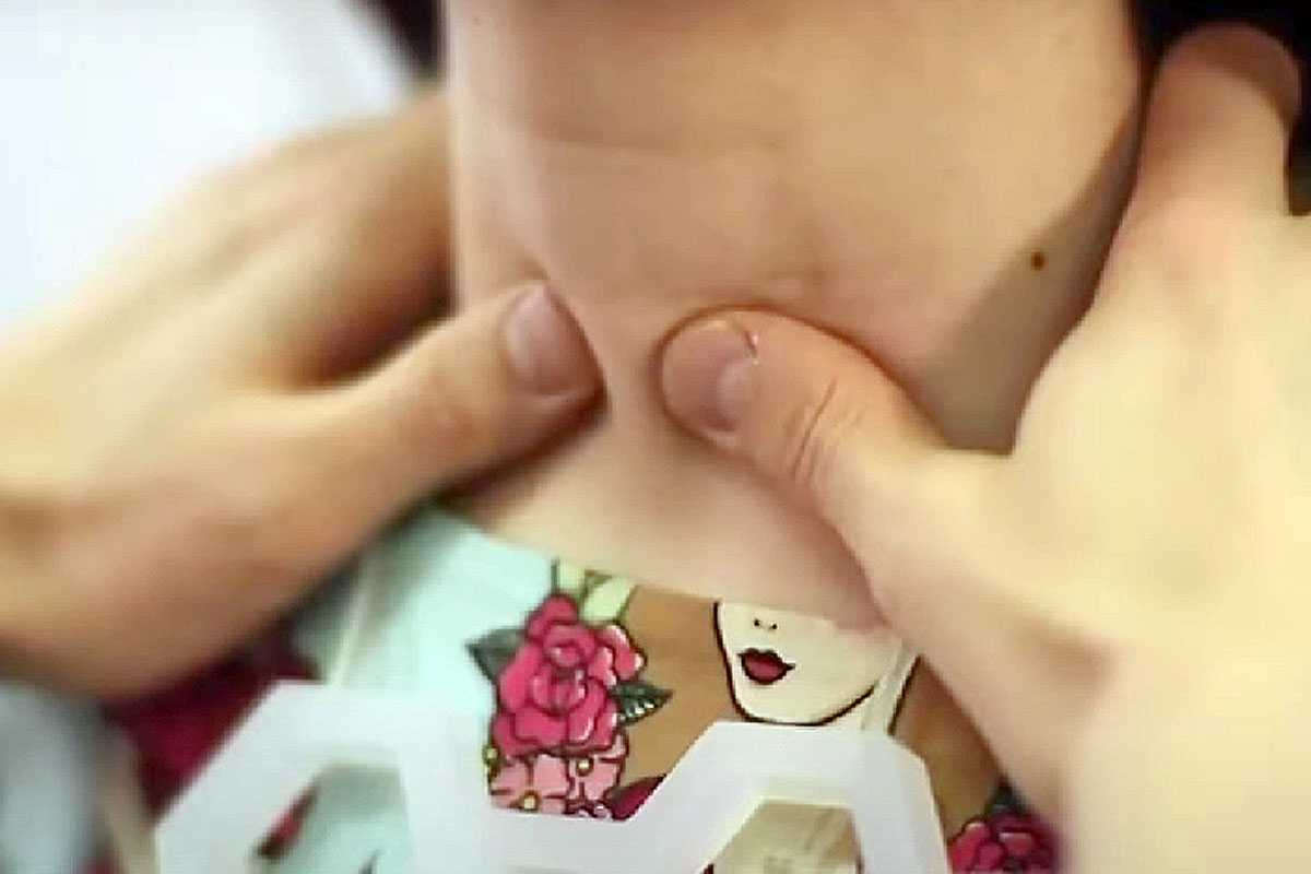 Тревожные сигналы: как распознать скрытые симптомы проблем со щитовидкой, можно остаться без волос