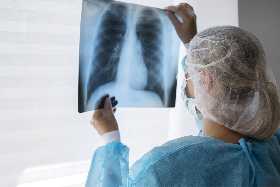 «Медицина бессильна»: врач Комиссарова назвала страшную болезнь, которую вызывает туберкулез