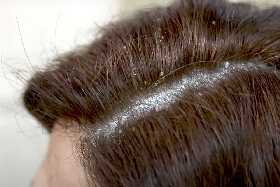 Росконтроль проверил: названа самая опасная краска для волос — стойкая, но крайне токсичная