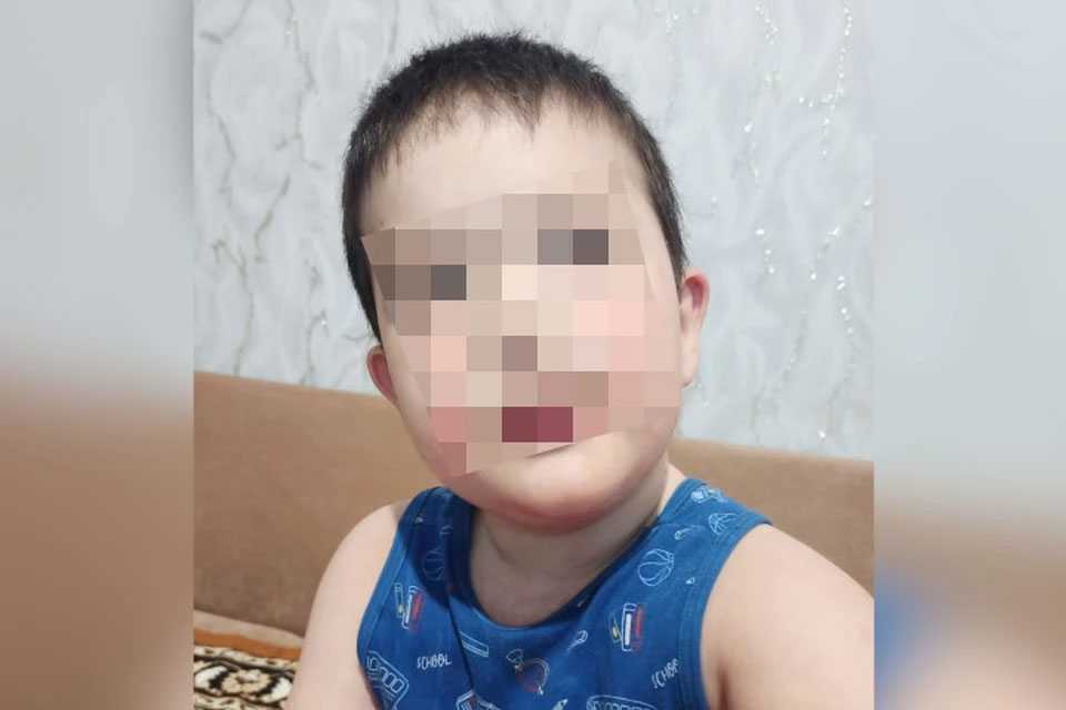 «Всё тело в пузырях»: уфимские врачи спасли трёхлетнего малыша с синдромом «ошпаренной кожи»