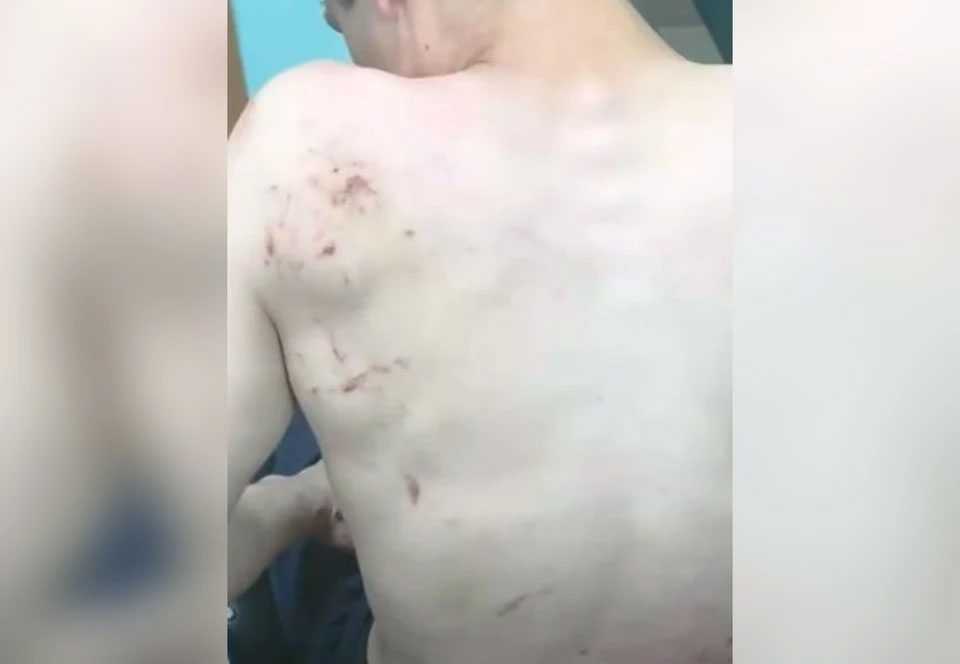 В Башкирии семья устроила самосуд над 18-летним парнем из-за поломанного скутера