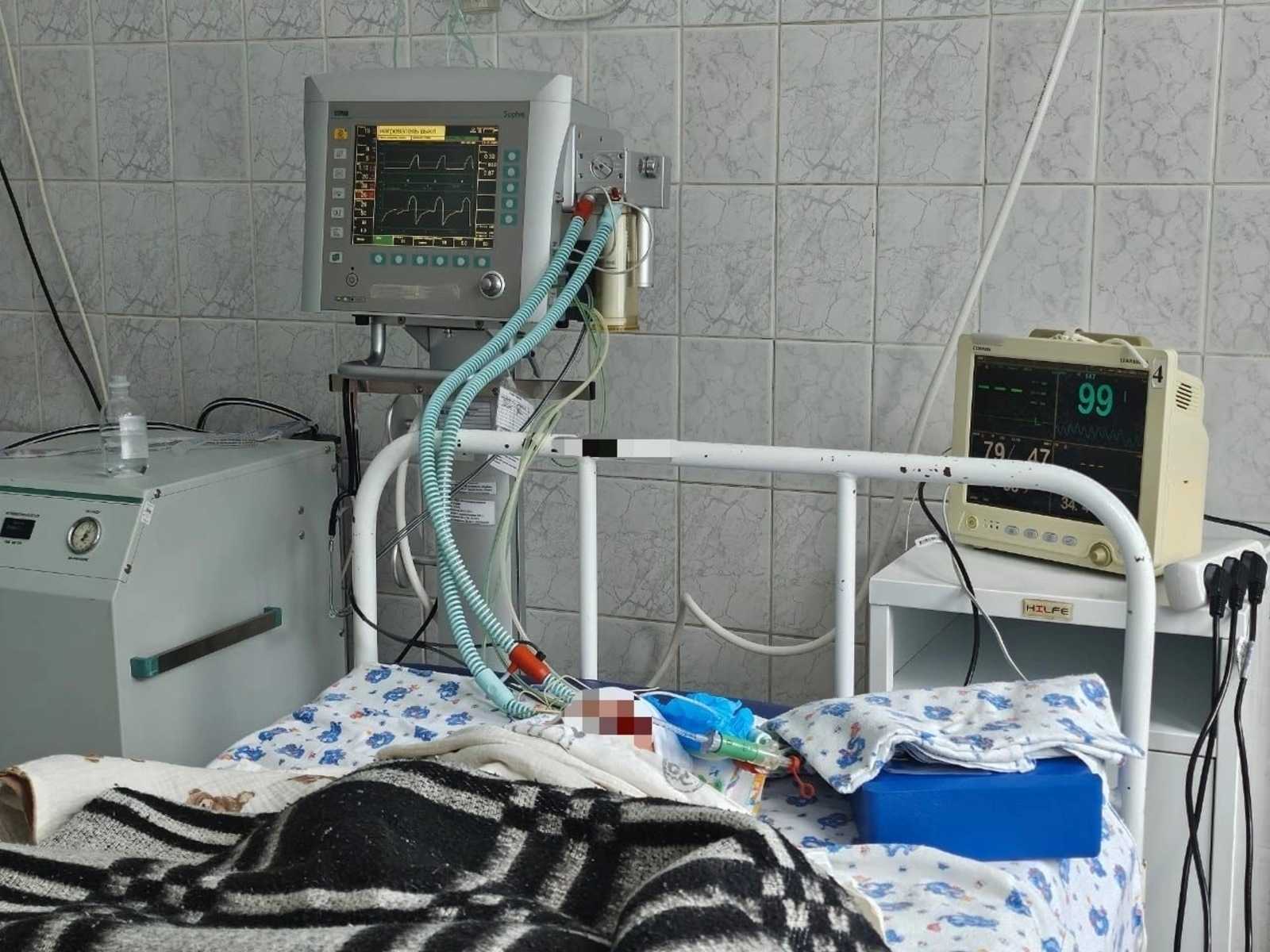 В Башкирии врачи борются за жизнь новорожденного с переломом черепа