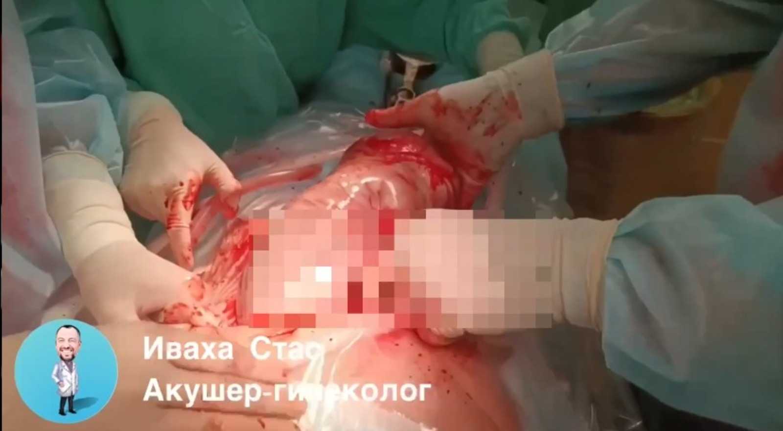 В Уфе девочка родилась «в рубашке»