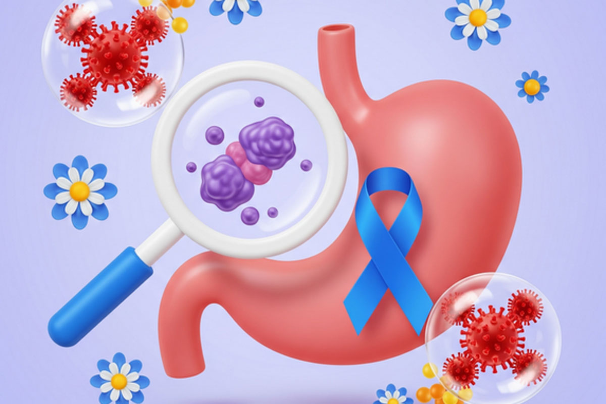 Стала известна причина осенних обострений проблем с ЖКТ, включая язву