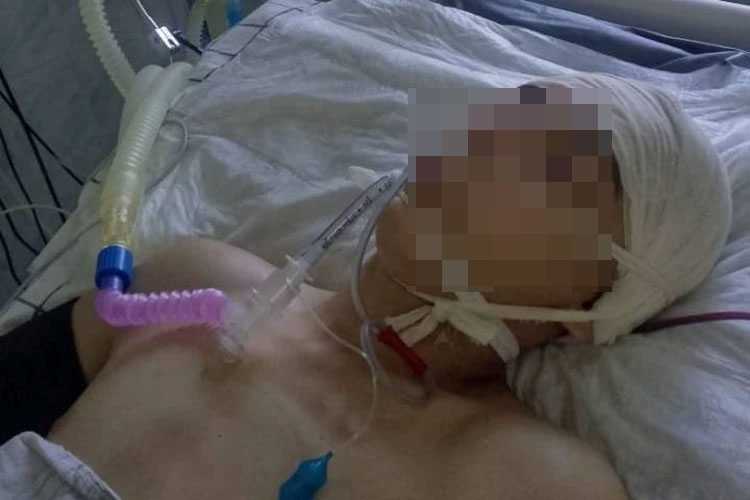 В Башкирии подросток два месяца находится в коме после жестокого избиения