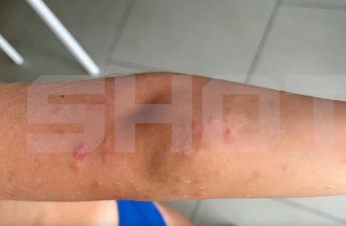 Неизвестный планктон «пожирает» русских туристов на пляжах Таиланда: среди пострадавших уже есть один ребёнок