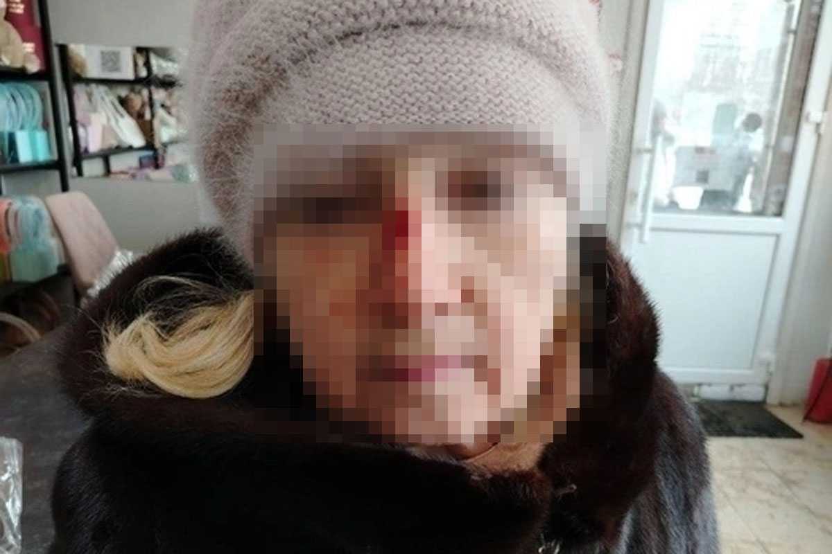 В Уфе выясняют обстоятельства инцидента с зажатой в троллейбусе пенсионеркой