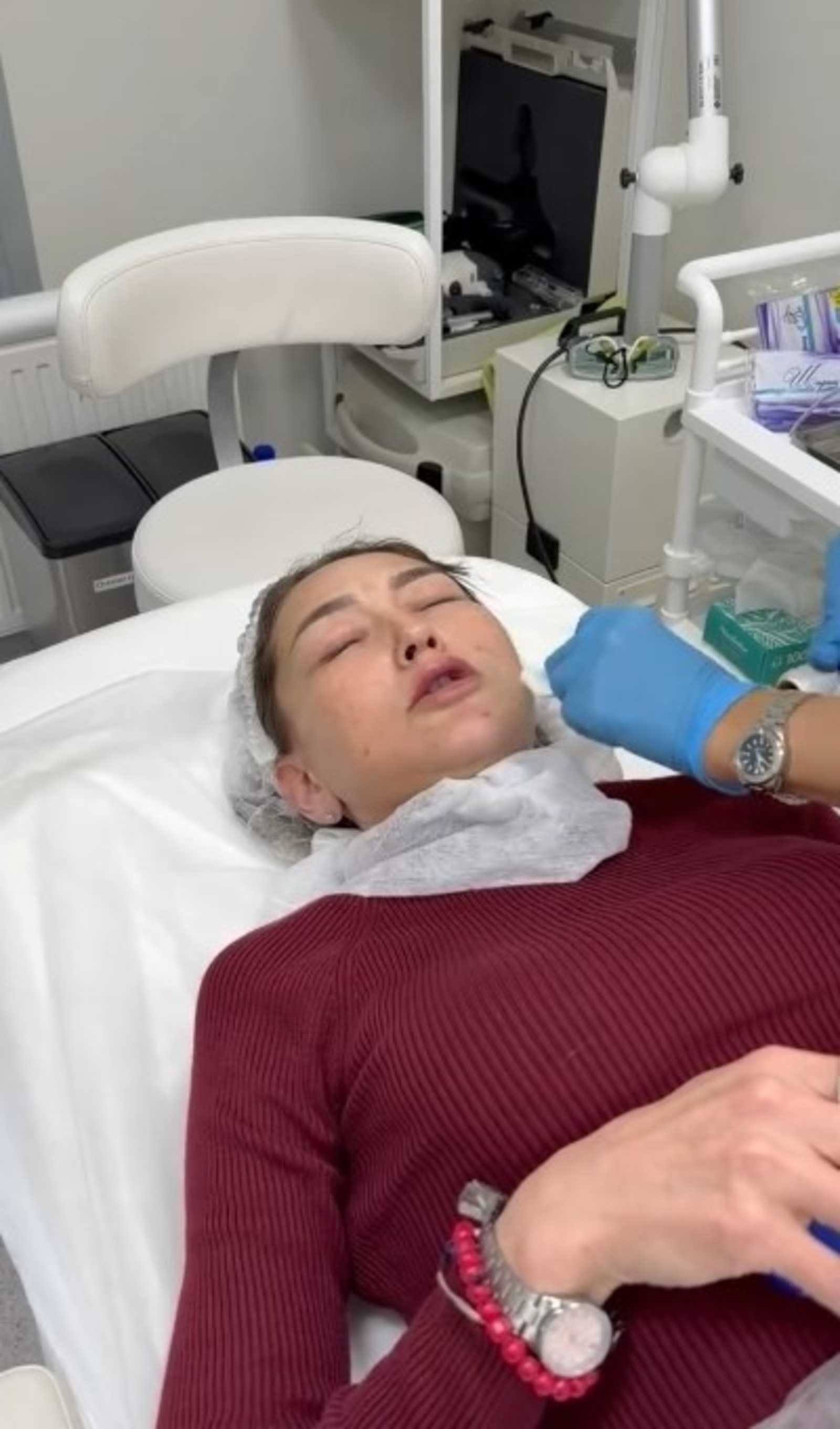 Башкирская домохозяйка увеличила губы и призналась, что не может остановиться